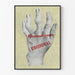 Póster vintage de mano deformada para reumatismos - Urodonal